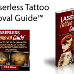Laserless Tattoo Removal